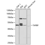 Western Blot - Anti-TPN Antibody (A90141) - Antibodies.com