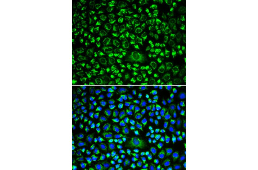 Immunofluorescence - Anti-TPN Antibody (A90141) - Antibodies.com
