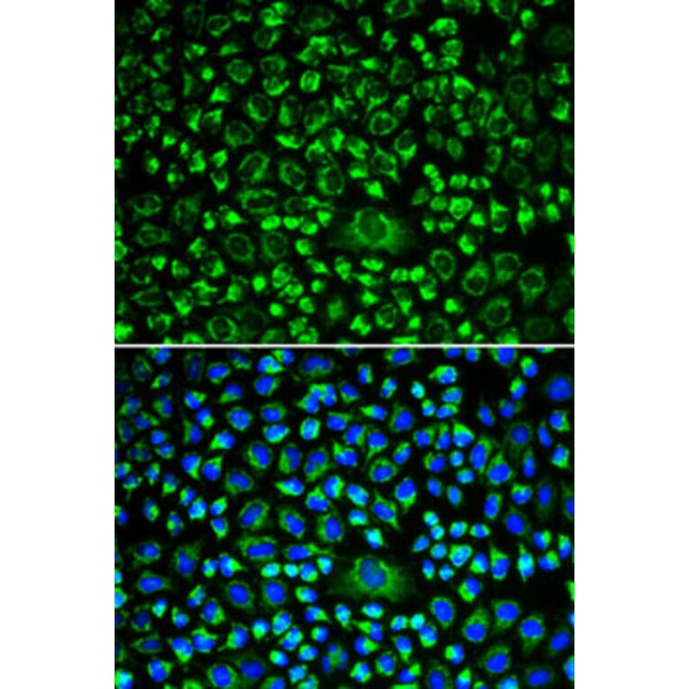 Immunofluorescence - Anti-TPN Antibody (A90141) - Antibodies.com
