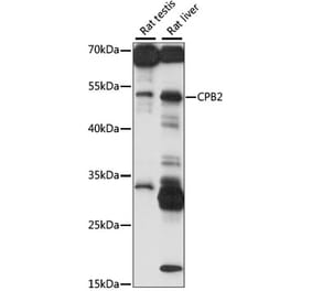 Western Blot - Anti-Carboxypeptidase B2 Antibody (A90142) - Antibodies.com