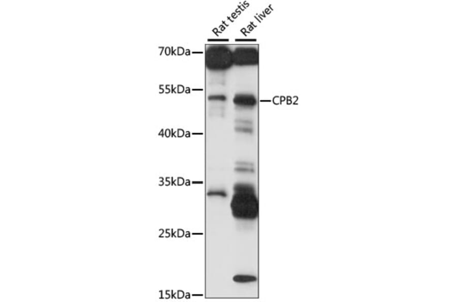 Western Blot - Anti-Carboxypeptidase B2 Antibody (A90142) - Antibodies.com