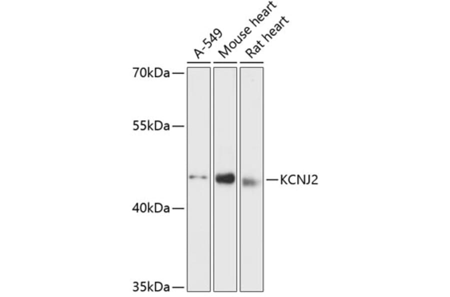 Western Blot - Anti-Kir2.1/KCNJ2 Antibody (A90143) - Antibodies.com
