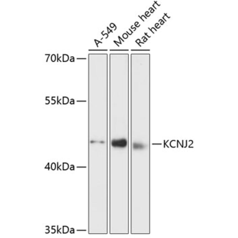 Western Blot - Anti-Kir2.1/KCNJ2 Antibody (A90143) - Antibodies.com
