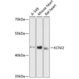 Western Blot - Anti-Kir2.1/KCNJ2 Antibody (A90143) - Antibodies.com