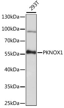 Western blot analysis of extracts of 293T cells, using Anti-PKNOX1 Antibody (A15301) at 1:1,000 dilution.
Secondary antibody: Goat Anti-Rabbit IgG (H+L) (HRP) (AS014) at 1:10,000 dilution.
Lysates / proteins: 25µg per lane.
Blocking buffer: 3% non-fat dry milk in TBST.
Detection: ECL Basic Kit (RM00020).
Exposure time: 30s.