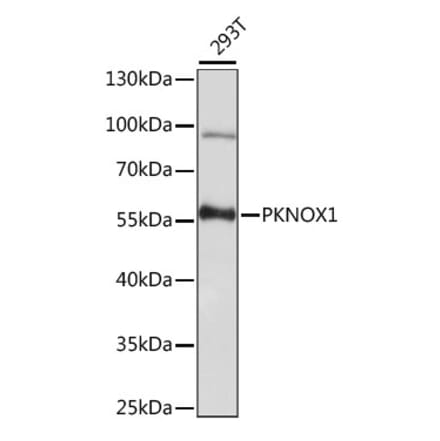 Western Blot - Anti-PREP1 Antibody (A90144) - Antibodies.com