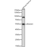Western Blot - Anti-PREP1 Antibody (A90144) - Antibodies.com