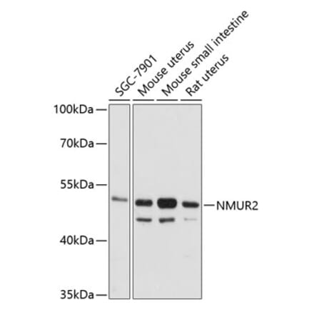 Western Blot - Anti-NMUR2 Antibody (A90145) - Antibodies.com