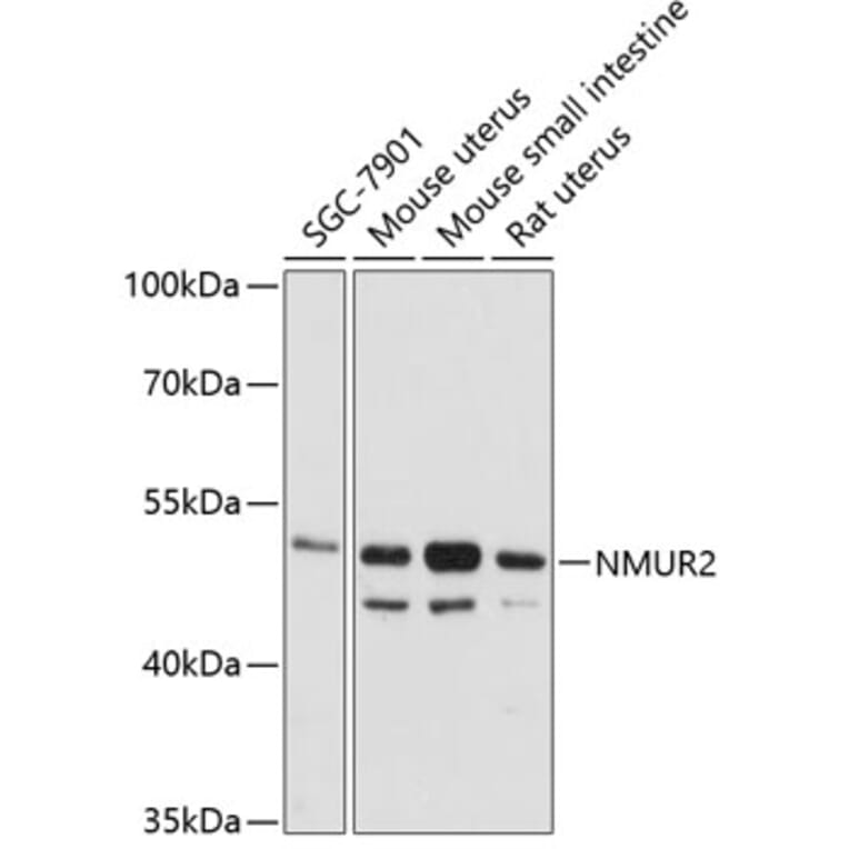 Western Blot - Anti-NMUR2 Antibody (A90145) - Antibodies.com