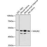 Western Blot - Anti-NMUR2 Antibody (A90145) - Antibodies.com