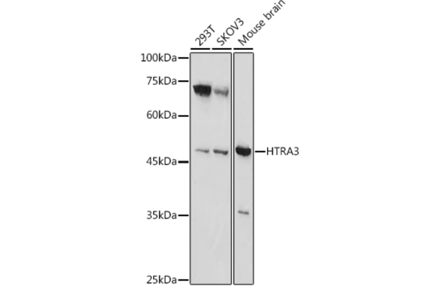 Western Blot - Anti-HtrA3 Antibody (A90146) - Antibodies.com