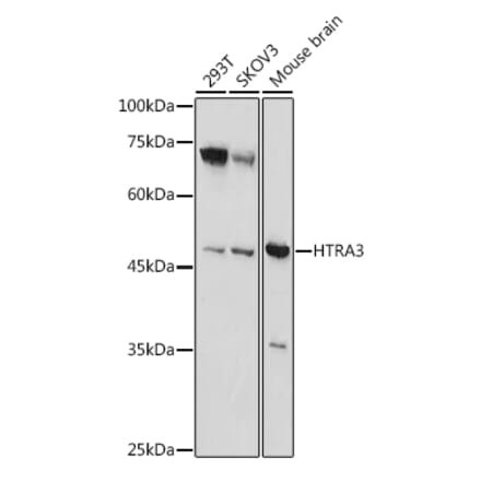 Western Blot - Anti-HtrA3 Antibody (A90146) - Antibodies.com