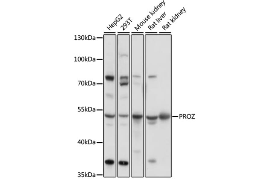 Western Blot - Anti-Protein Z Antibody (A90147) - Antibodies.com