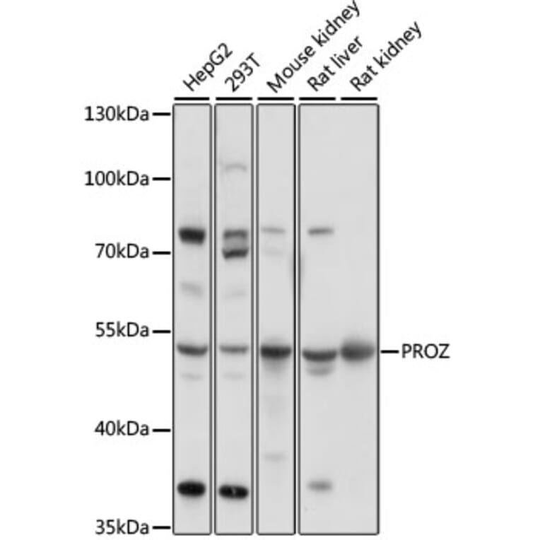 Western Blot - Anti-Protein Z Antibody (A90147) - Antibodies.com