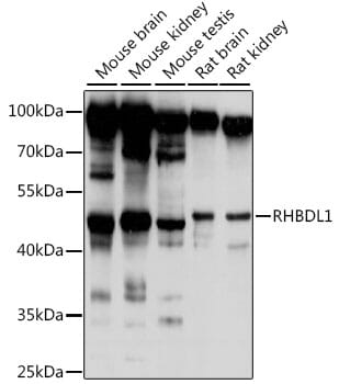 Western blot analysis of extracts of various cell lines, using Anti-RHBDL1 Antibody (A16084) at 1:1,000 dilution.
Secondary antibody: Goat Anti-Rabbit IgG (H+L) (HRP) (AS014) at 1:10,000 dilution.
Lysates / proteins: 25µg per lane.
Blocking buffer: 3% non-fat dry milk in TBST.
Detection: ECL Basic Kit (RM00020).
Exposure time: 10s.