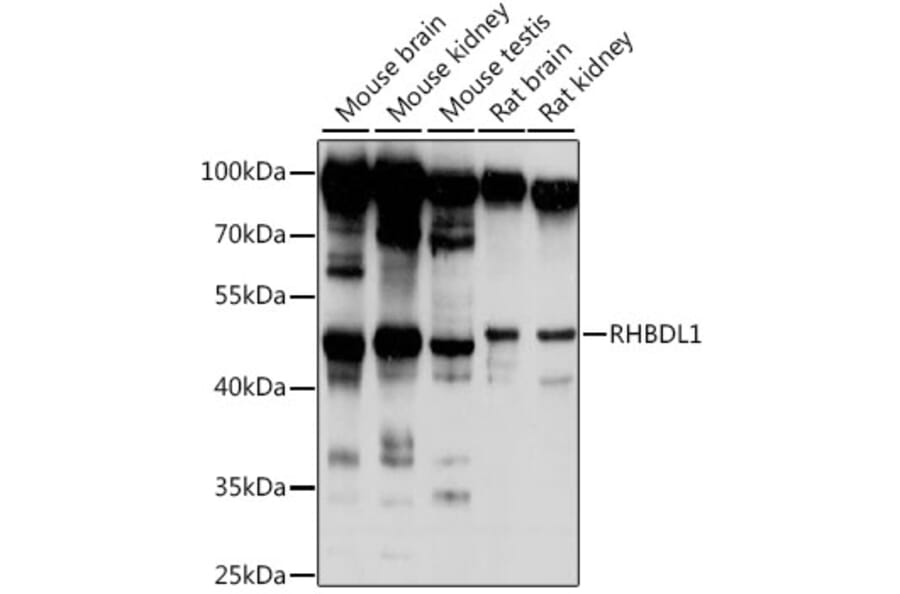 Western Blot - Anti-RHBDL1 Antibody (A90148) - Antibodies.com