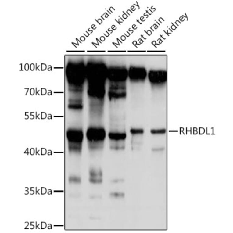 Western Blot - Anti-RHBDL1 Antibody (A90148) - Antibodies.com