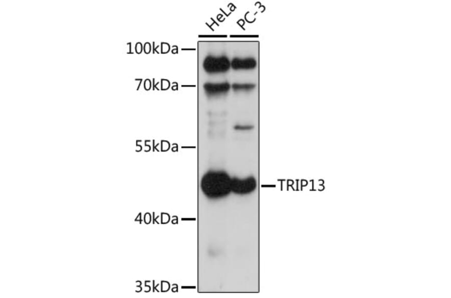 Western Blot - Anti-TRIP13/PCH2 Antibody (A90149) - Antibodies.com
