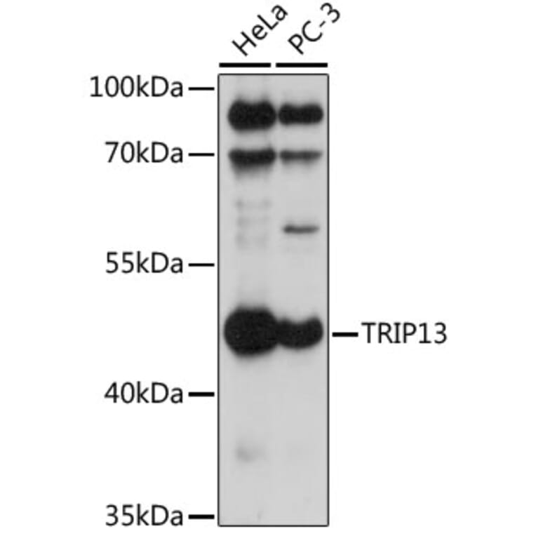 Western Blot - Anti-TRIP13/PCH2 Antibody (A90149) - Antibodies.com