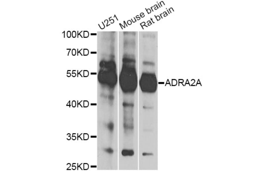 Western Blot - Anti-ADRA2A Antibody (A13941) - Antibodies.com