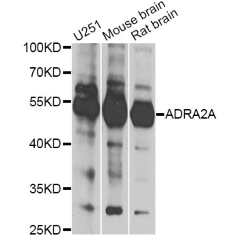 Western Blot - Anti-ADRA2A Antibody (A13941) - Antibodies.com