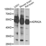 Western Blot - Anti-ADRA2A Antibody (A13941) - Antibodies.com
