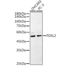 Western Blot - Anti-FOXL2 Antibody (A90153) - Antibodies.com