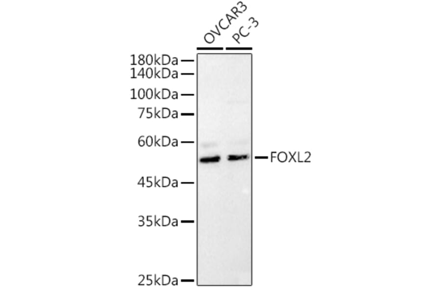 Western Blot - Anti-FOXL2 Antibody (A90153) - Antibodies.com