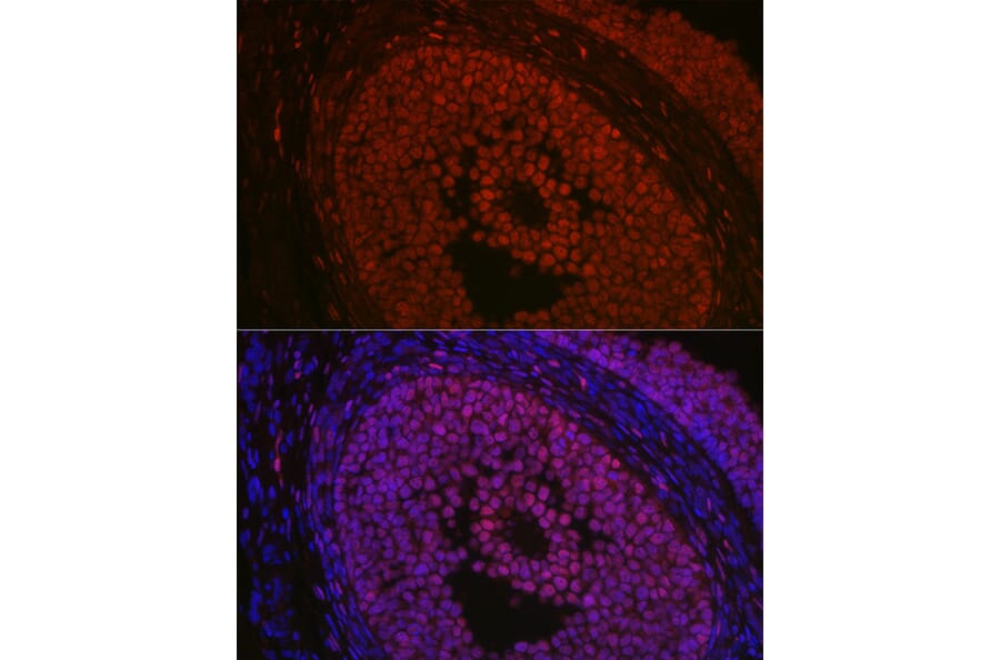 Immunofluorescence - Anti-FOXL2 Antibody (A90153) - Antibodies.com
