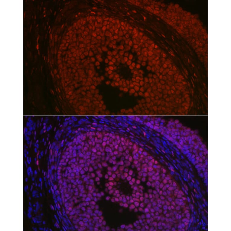 Immunofluorescence - Anti-FOXL2 Antibody (A90153) - Antibodies.com