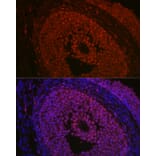 Immunofluorescence - Anti-FOXL2 Antibody (A90153) - Antibodies.com