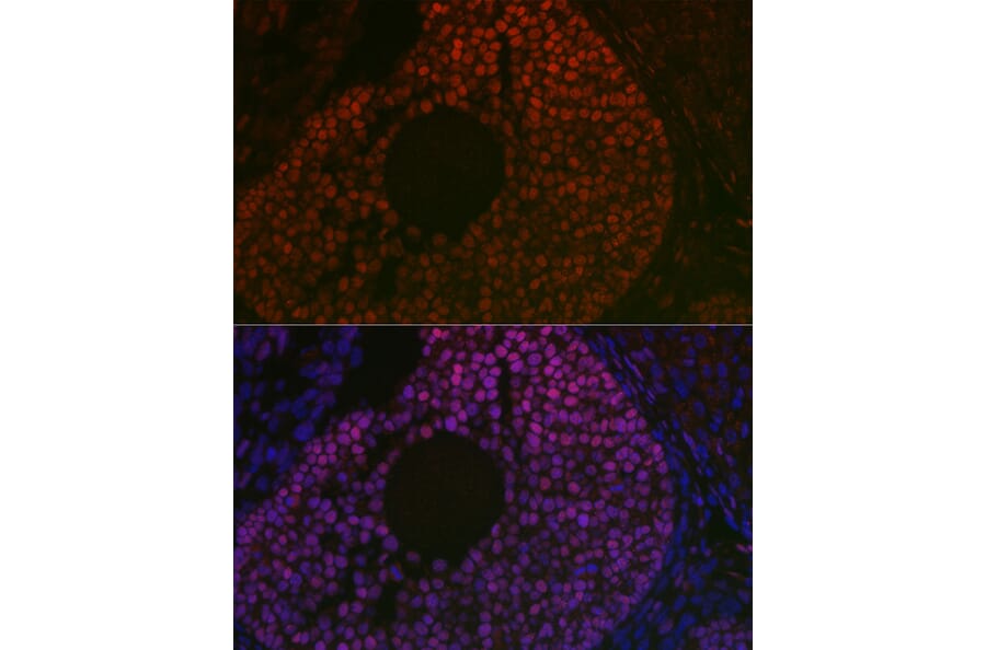 Immunofluorescence - Anti-FOXL2 Antibody (A90153) - Antibodies.com