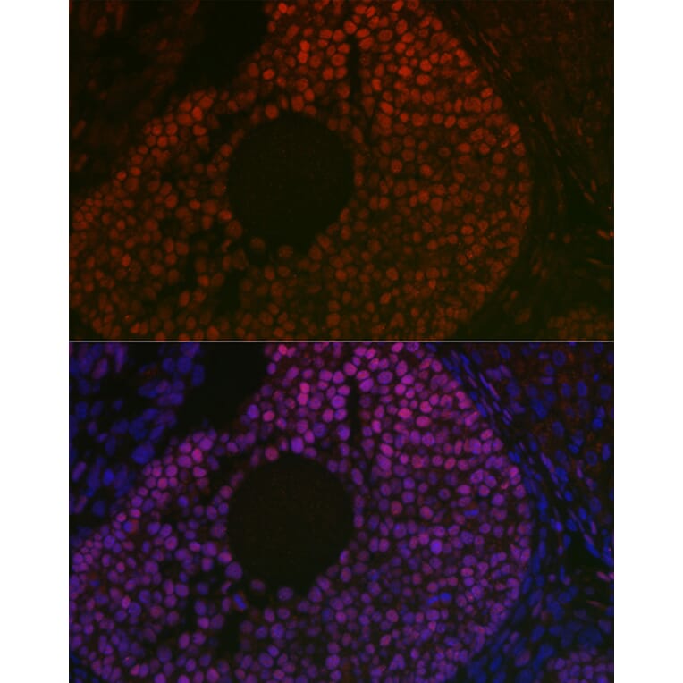 Immunofluorescence - Anti-FOXL2 Antibody (A90153) - Antibodies.com