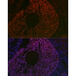Immunofluorescence - Anti-FOXL2 Antibody (A90153) - Antibodies.com