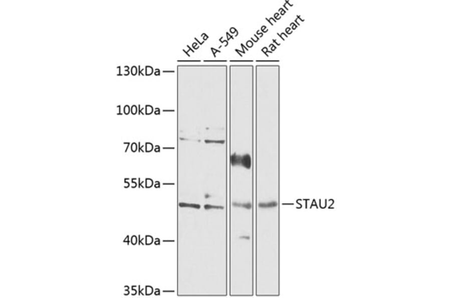 Western Blot - Anti-STAU2 Antibody (A90154) - Antibodies.com
