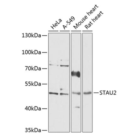 Western Blot - Anti-STAU2 Antibody (A90154) - Antibodies.com