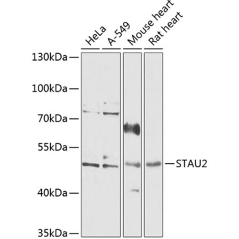 Western Blot - Anti-STAU2 Antibody (A90154) - Antibodies.com