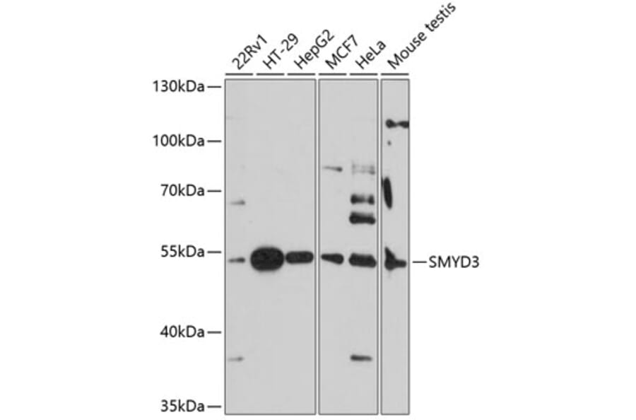 Western Blot - Anti-SMYD3 Antibody (A90155) - Antibodies.com
