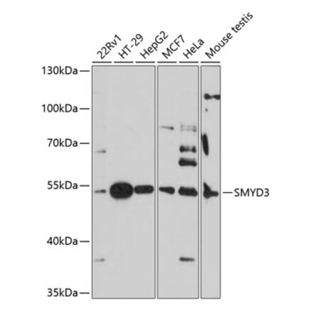 Western Blot - Anti-SMYD3 Antibody (A90155) - Antibodies.com