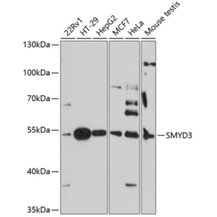 Western Blot - Anti-SMYD3 Antibody (A90155) - Antibodies.com