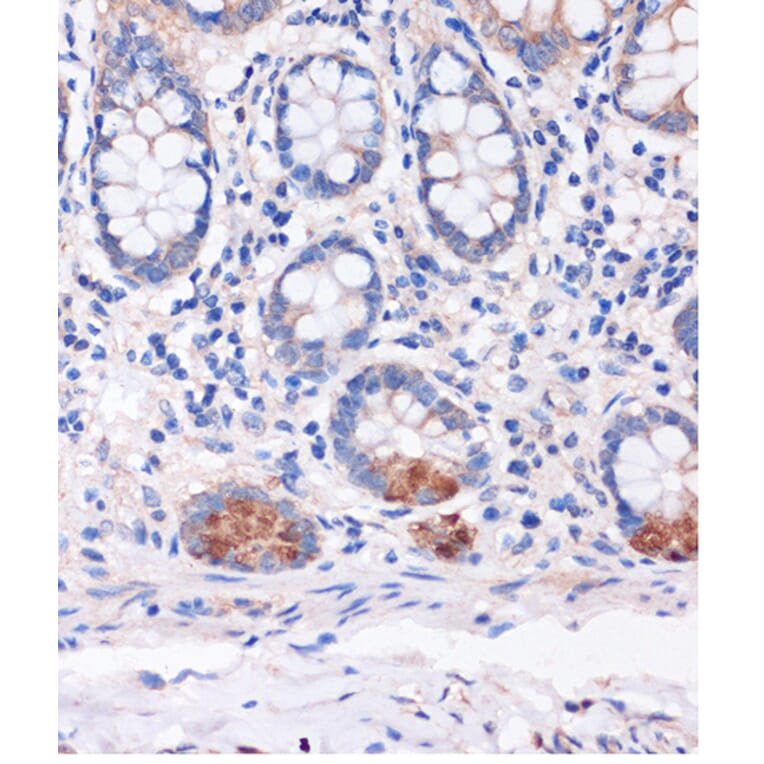 Immunohistochemistry - Anti-SMYD3 Antibody (A90155) - Antibodies.com