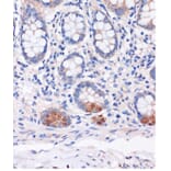 Immunohistochemistry - Anti-SMYD3 Antibody (A90155) - Antibodies.com