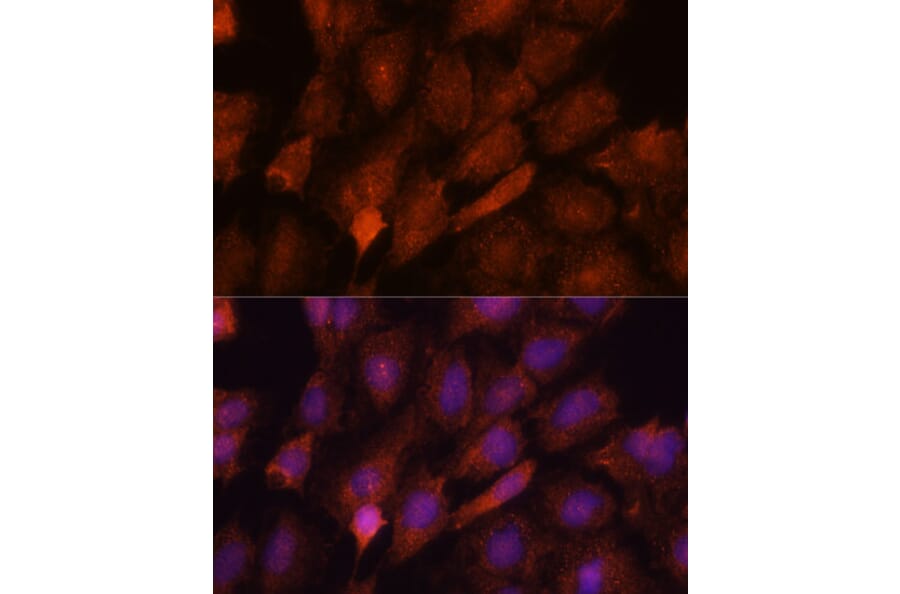 Immunofluorescence - Anti-SMYD3 Antibody (A90155) - Antibodies.com