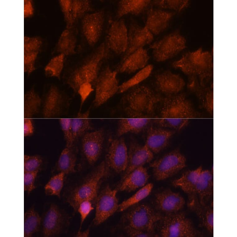 Immunofluorescence - Anti-SMYD3 Antibody (A90155) - Antibodies.com