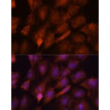 Immunofluorescence - Anti-SMYD3 Antibody (A90155) - Antibodies.com