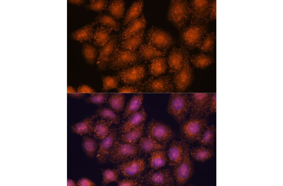 Immunofluorescence - Anti-SMYD3 Antibody (A90155) - Antibodies.com