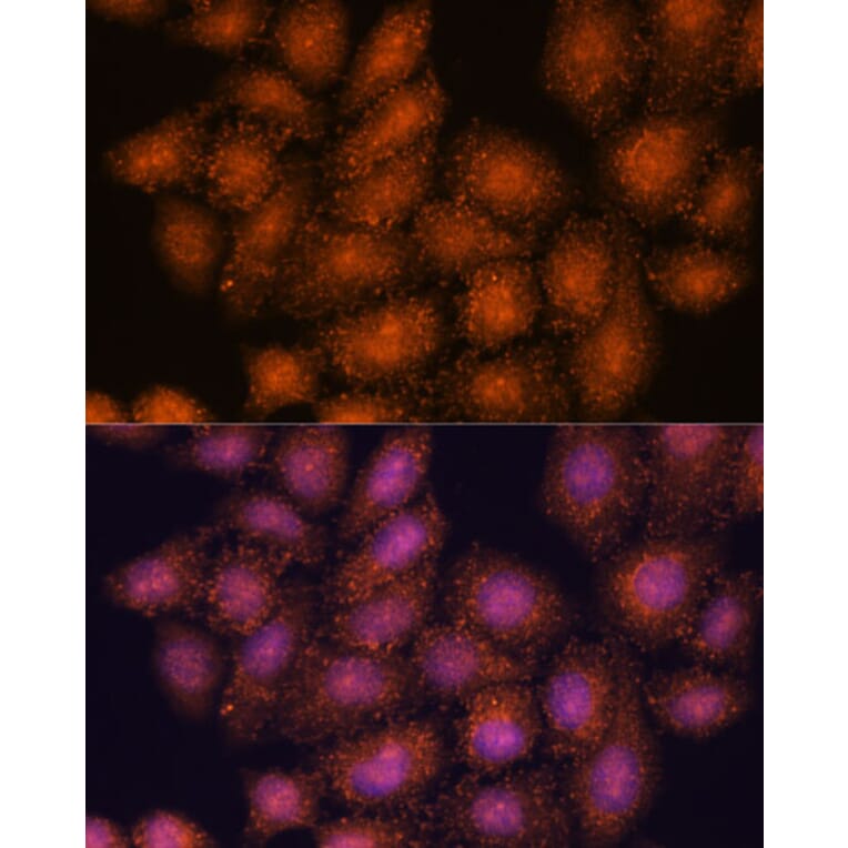 Immunofluorescence - Anti-SMYD3 Antibody (A90155) - Antibodies.com