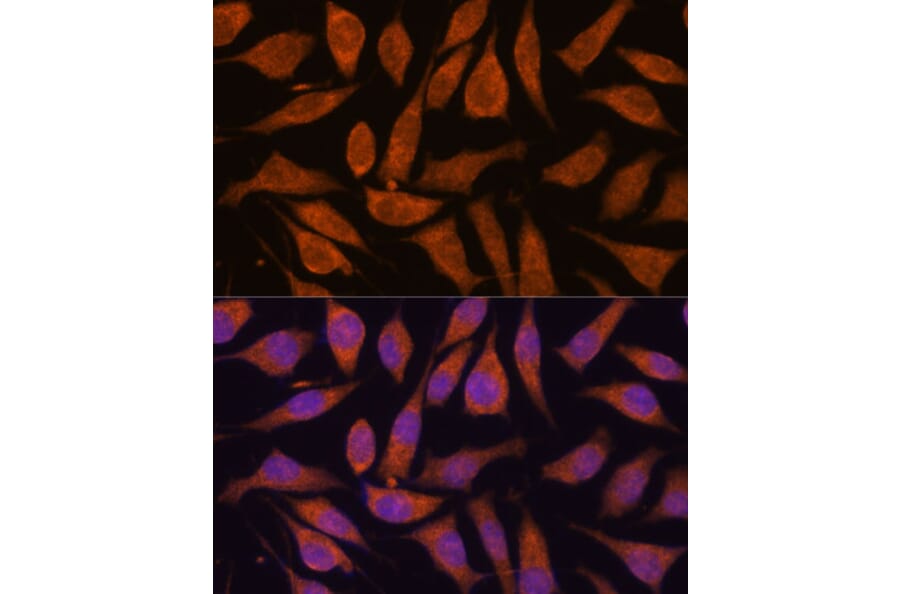 Immunofluorescence - Anti-SMYD3 Antibody (A90155) - Antibodies.com