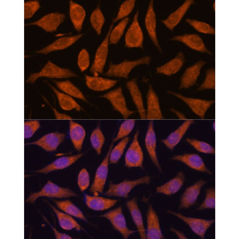 Immunofluorescence - Anti-SMYD3 Antibody (A90155) - Antibodies.com