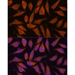 Immunofluorescence - Anti-SMYD3 Antibody (A90155) - Antibodies.com